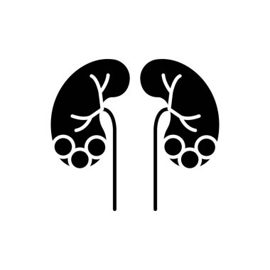 Böbrek taşı hastalığı siyah sembol. Erimiş mineraller ve tuzlar. Urolithias. Üreter tıkanmış. Kandaki atık ürünler. Beyaz uzayda siluet sembolü. Vektör izole illüstrasyonu