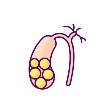 Gallstones RGB color icon. Cholelithiasis. Hardened bile deposits. Solid material in gallbladder. Gall stones. Digestive discomfort. Abdominal pain. Bile ducts. Isolated vector illustration clipart