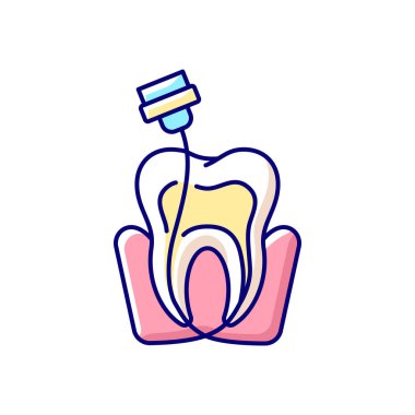 Endodontik RGB renk simgesi. Endodontikler günlüğü. Diş tedavisi için aletler. Profesyonel stomatoloji kapsülü. Ozmetik dişçilik. Diş ameliyatı. İzole edilmiş vektör karatahta çizimi