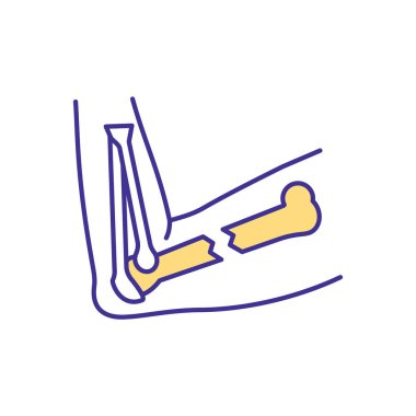 Dirsek kırığı RGB renk simgesi. Görünür kol deformasyonu. Kırık kemikler. Ani ve yoğun bir ağrı. Eklem yüzeyi hasarı. Sinir hasarı. Kaslar burkulur, gerilir ve yerinden çıkar. İzole vektör illüstrasyonu