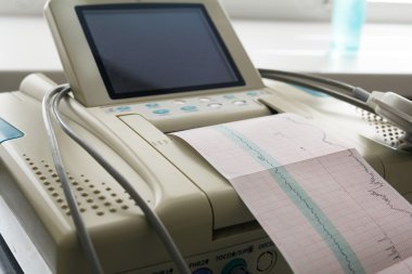 Printing of cardiogram report coming out from Electrocardiograph in labour ward clipart