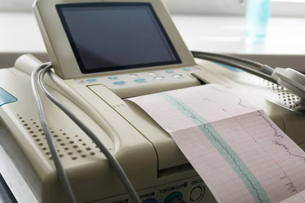 Electrocardiograph emek koğuşta gelen kardiyogram rapor baskı