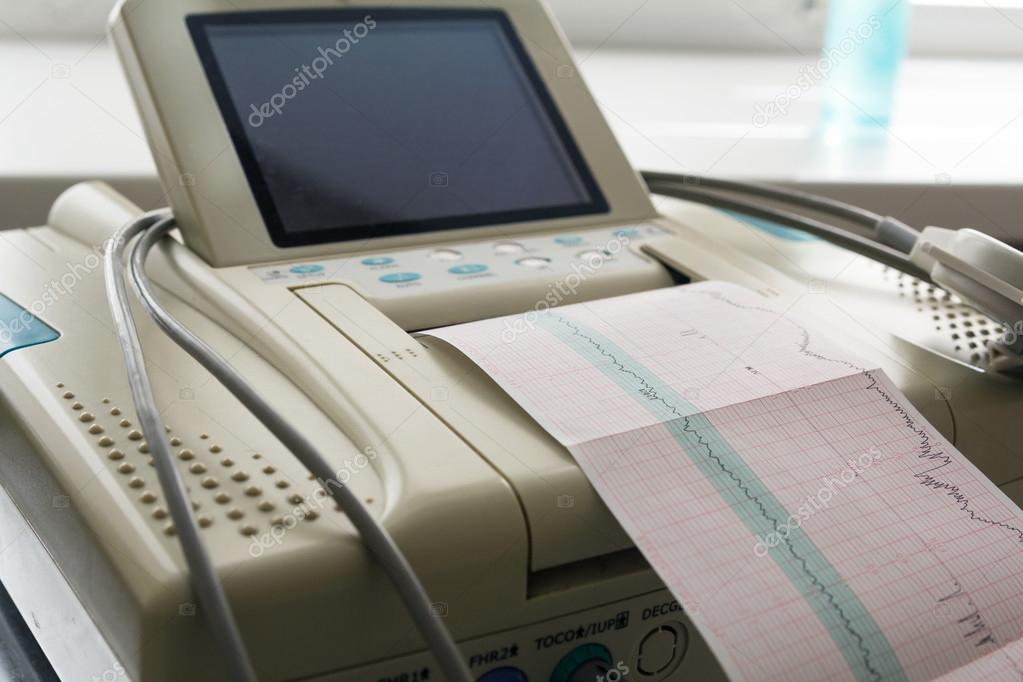 Printing of cardiogram report coming out from Electrocardiograph in labour ward