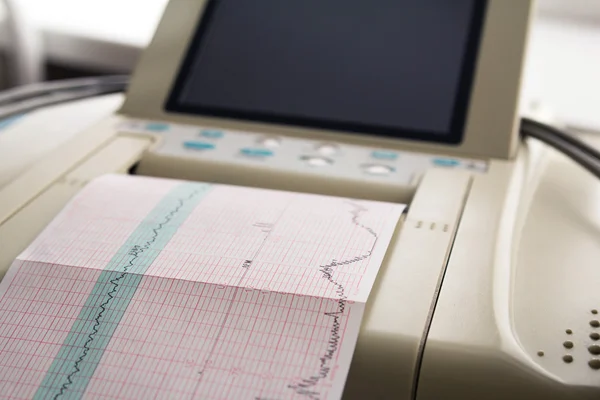 Impresión del informe del cardiograma procedente del electrocardiograma en la sala de parto — Foto de Stock