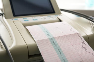 Printing of cardiogram report coming out from Electrocardiograph in labour ward clipart
