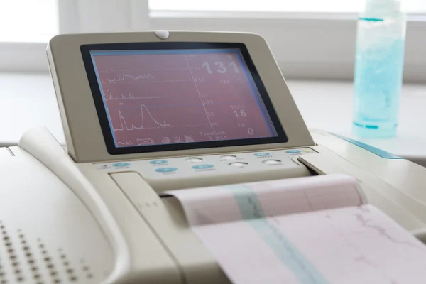 Electrocardiograph emek koğuşta gelen kardiyogram rapor baskı