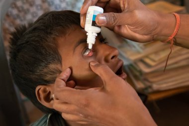 Rajasthan. Hindistan. 07-02-2018. Çocuk gözlerinde bir sorun olduğu için doktordan tıbbi yardım alıyor..