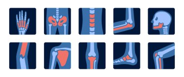 İnsan eklem anatomisinin röntgenleri ve ağrı organları. Kemiklerin röntgen incelemesi. Tıbbi ve bilimsel illüstrasyon.