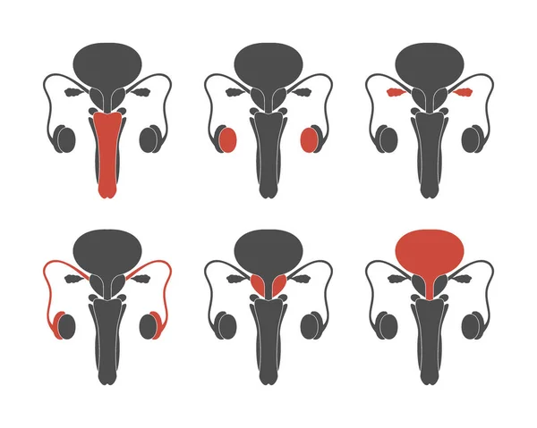 Zestaw męskiego układu rozrodczego z różnymi organami oznaczonymi kolorem czerwonym. Medyczne treści edukacyjne — Wektor stockowy