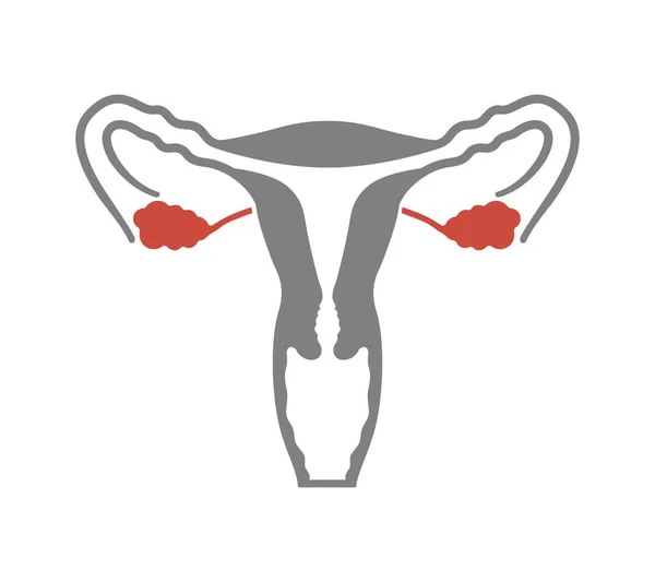 Sistema reproductor humano femenino con órgano de color rojo marcado. Contenido educativo médico — Vector de stock