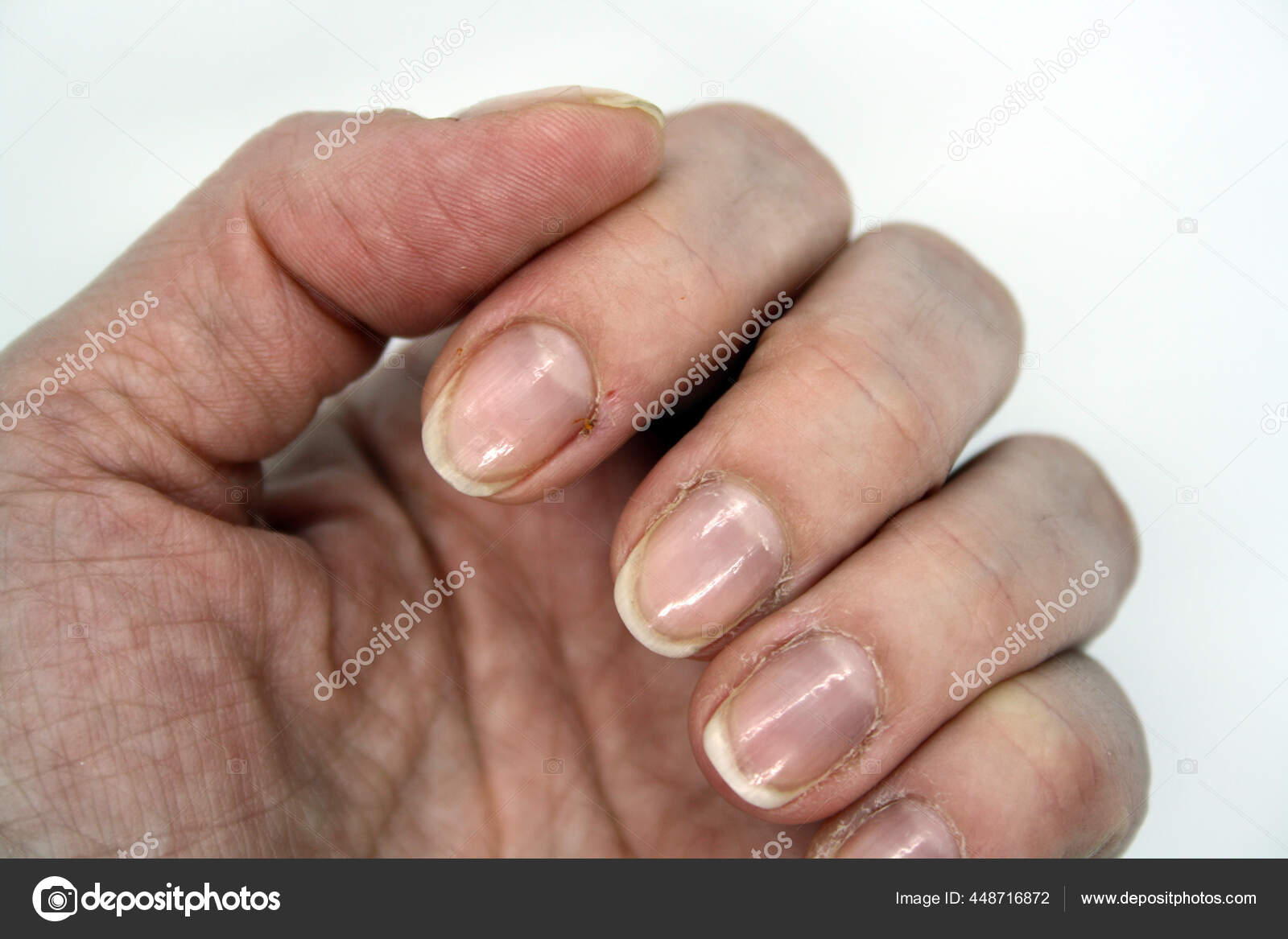 Fingernägel männer künstliche