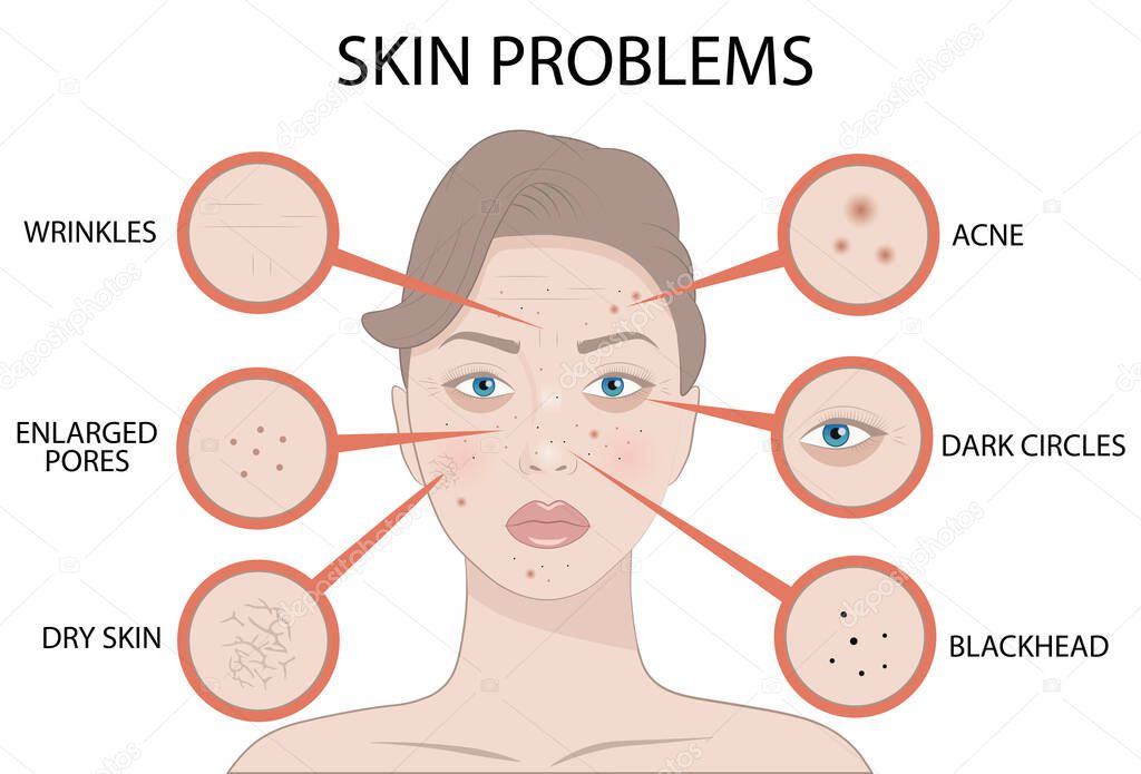 Girl Face with Skin problems, cosmetic care and beauty cosmetics medicine vector illustration isolated on white
