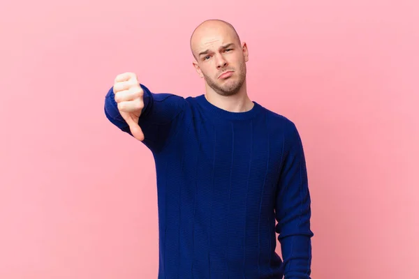 Bald Man Feeling Cross Angry Annoyed Disappointed Displeased Showing Thumbs — Stock Photo, Image