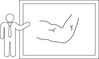 Çubuk bir figür beyaz tahta üzerinde kaslı bir kol çizimi sunar, basit ve açıklayıcı bir şekilde gücü ve uygunluğu vurgular..