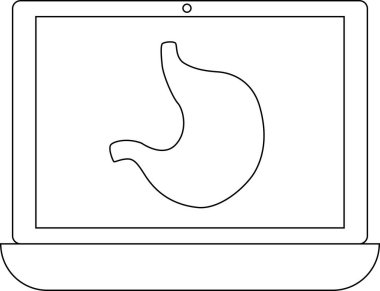 Laptop ekranında mide diyagramı gösteriliyor, muhtemelen tıp eğitimi ya da sağlık hizmetleri bilgi amaçlı. Görüntü basit ve net..