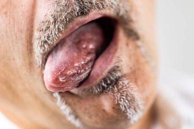 Dilini çıkarmış bir adama yaklaş.