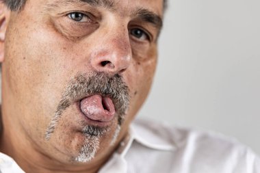 Dilini katlayan sakallı bir adam.