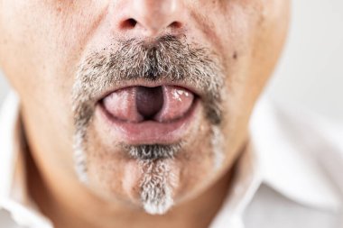 Adam dudaklarını ve dilini gösteriyor.