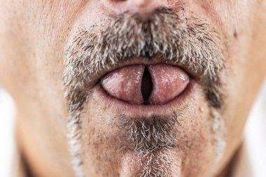 Yakından bakınca bıyıklı adamın dili görünüyor.