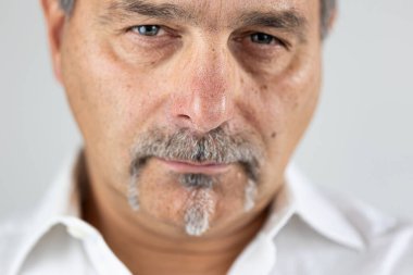 Yetişkin bir adamın şaşı ifadesi