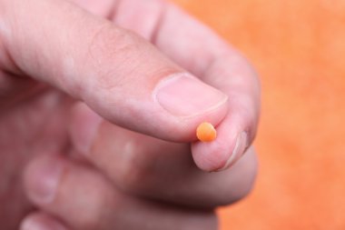 Parmakları kırmızı mercimek