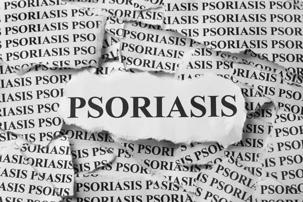 Psoriasis — Stockfoto