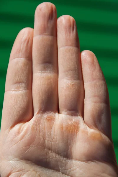 A man\'s palm with four fingers, calluses and dry skin . Selective focus. Close-up