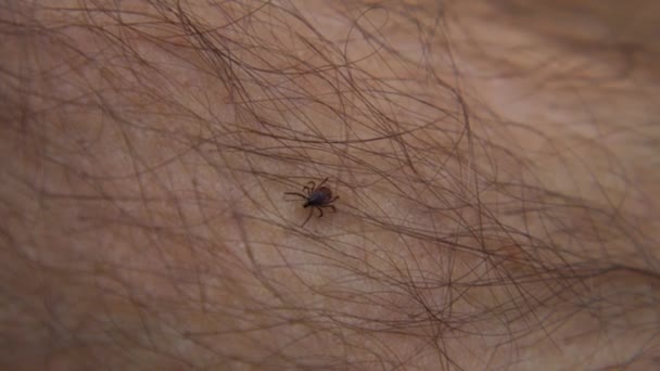 Forest Mite Crawls Human Leg Hair Macro Blood Sucking Insect — Stock Video