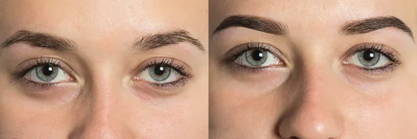 Partie des sourcils du visage avant après — Photo