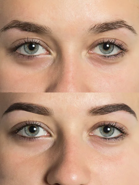 Part of face eyebrows before after — Stock Photo, Image