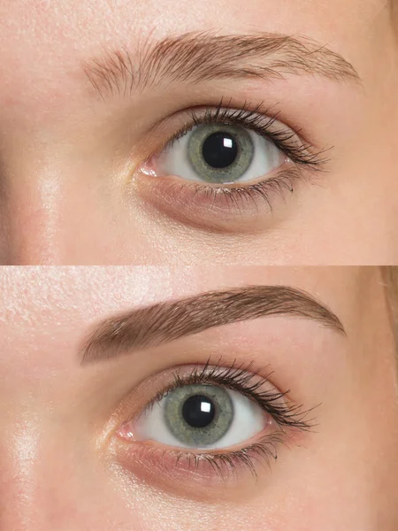 Eye brows before after correction