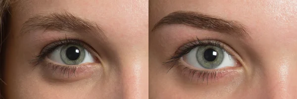 Cejas de ojos antes después de la corrección —  Fotos de Stock