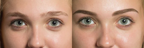 Cejas de ojos antes después de la corrección —  Fotos de Stock