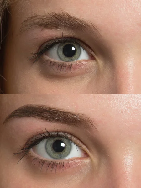 Eye brows before after correction — Stock Photo, Image