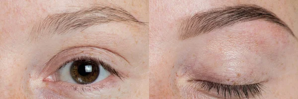 Antes y después de cejas de ojos — Foto de Stock