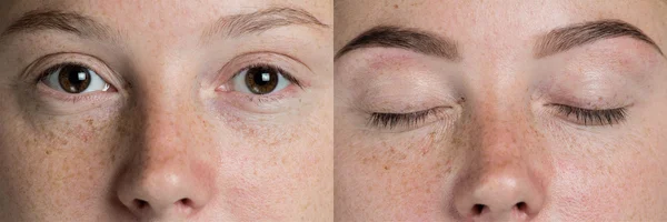 Eyebrows before after — Stock Photo, Image