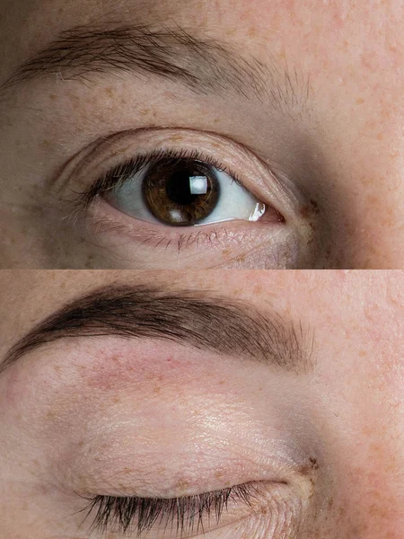 Before and after eye brows — Stock Photo, Image