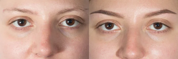 Part of face eyebrows before after — Stock Photo, Image