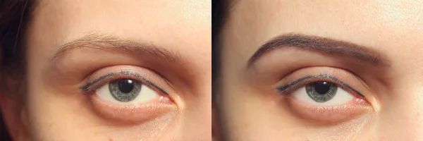 Eyebrows before after — Stock Photo, Image