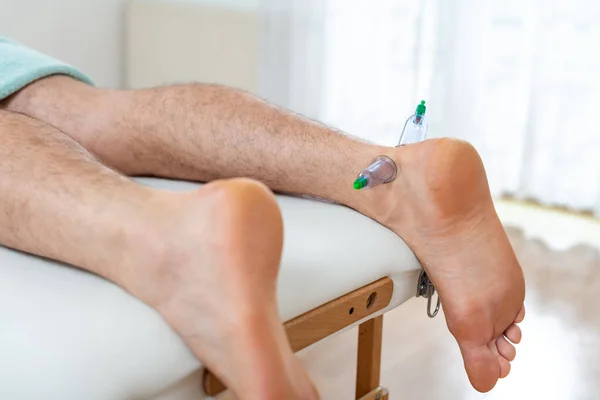 Vacuum Cupping Therapy Background. Suction cups on the leg of a male patient, to relieve ankle joint pain, closeup detail.