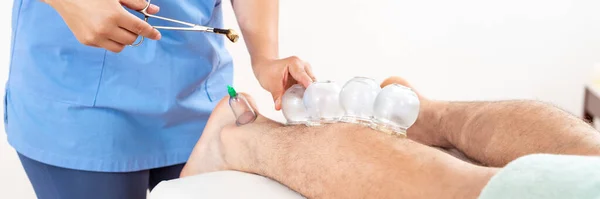 Vacuum Cupping Therapy Banner. Young female physiotherapist applying glass suction banks on the leg of her patient, during vacuum cupping therapy, closeup detail.