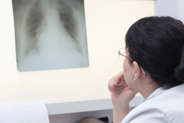 Doctora examinando una radiografía — Foto de Stock