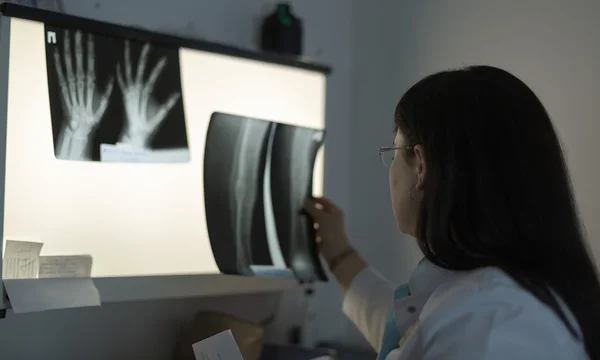 Médica examinando um raio-x — Fotografia de Stock