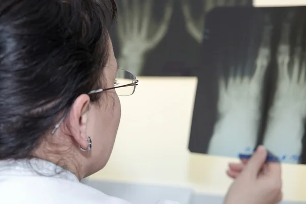 여성 의사는 x 선 검사 — 스톡 사진