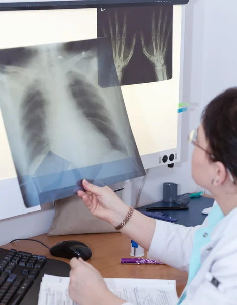 Médica examinando um raio-x — Fotografia de Stock