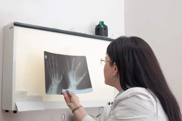 Médica examinando um raio-x — Fotografia de Stock