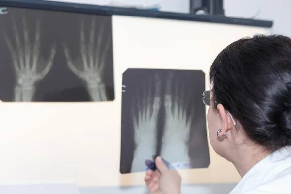 Médica examinando um raio-x — Fotografia de Stock
