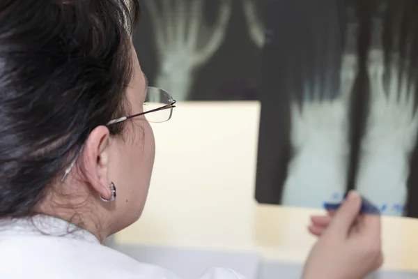 Doctora examinando una radiografía — Foto de Stock