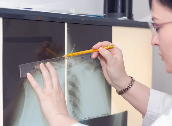 Ärztin untersucht ein Röntgenbild — Stockfoto