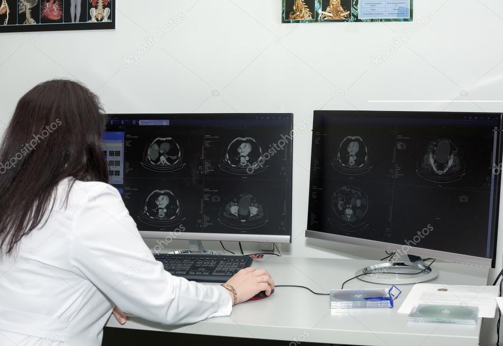 Female doctor examining CT scanner results